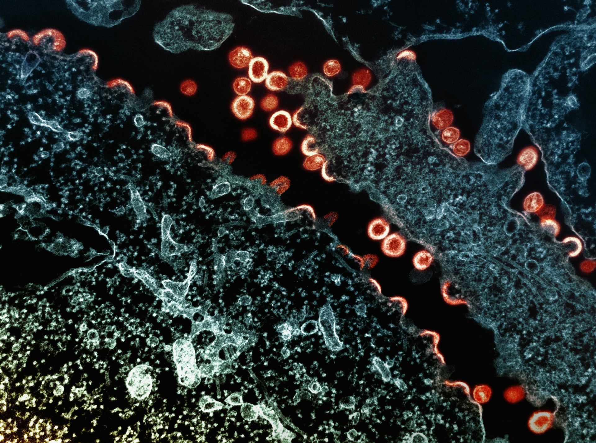 Why GEME Composter chose aerobic digestion over grinding.